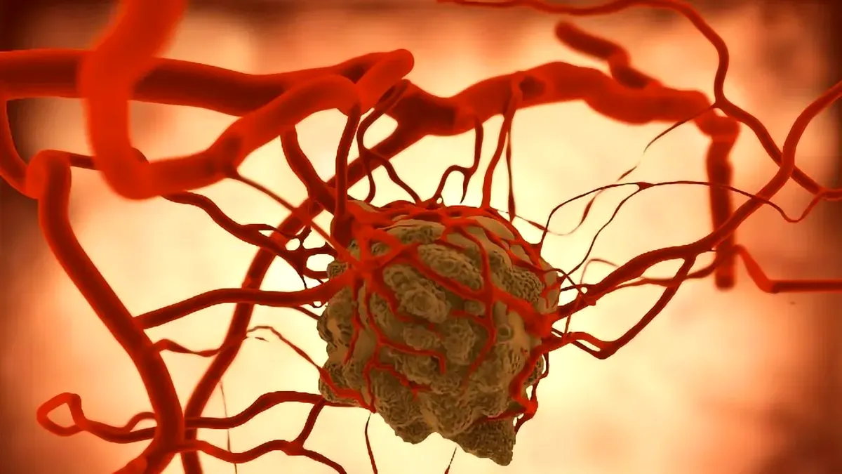 Apel în sprijinul pacienților cu neurofibromatoză de tip 1:  diagnostic fără întârzieri, tratament fără întreruperi!