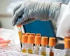Românii care pot face analize medicale gratuit. Condiția simplă, care îi scutește de costuri