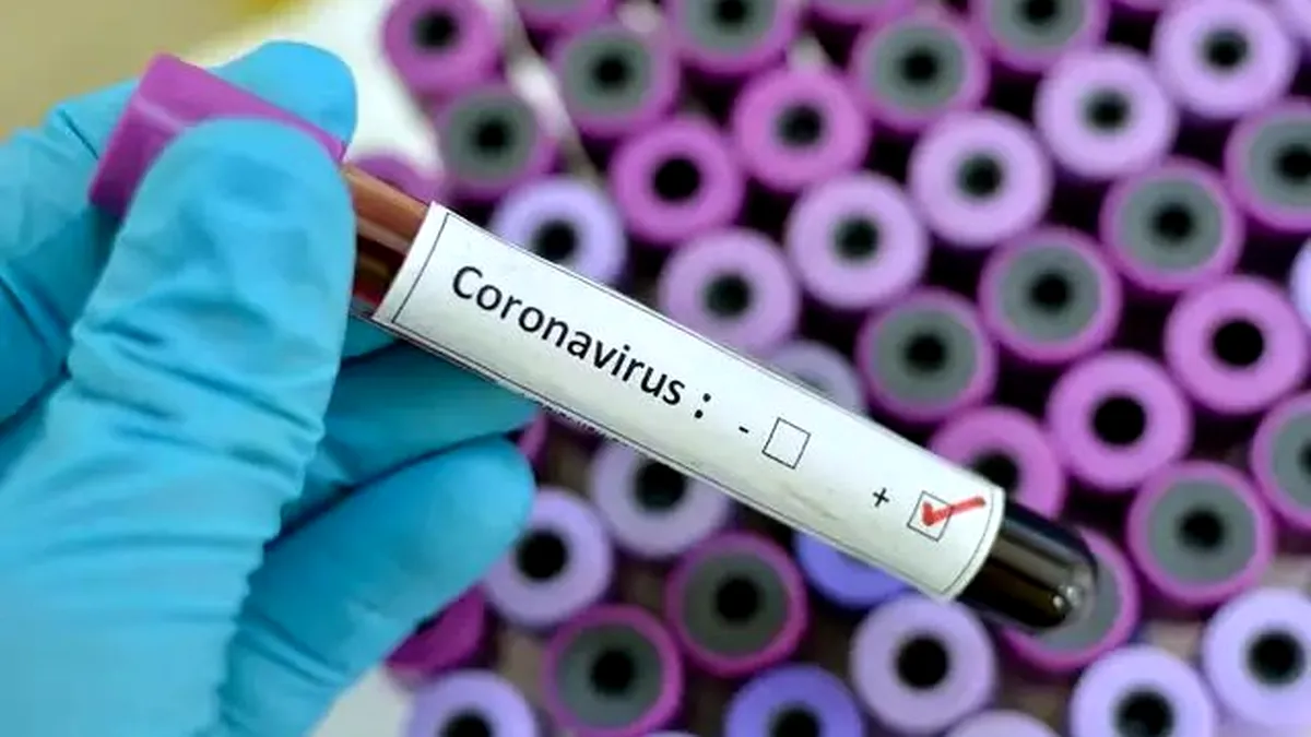 Anunț sumbru | Epidemiolog: La 14 septembrie am putea avea peste 1.800 de cazuri noi de coronavirus pe zi