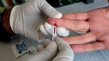 Epidemie în plin sezon estival: autoritățile emit avertismente de călătorie pentru patru destinații turistice populare din Europa. Nouă persoane au murit