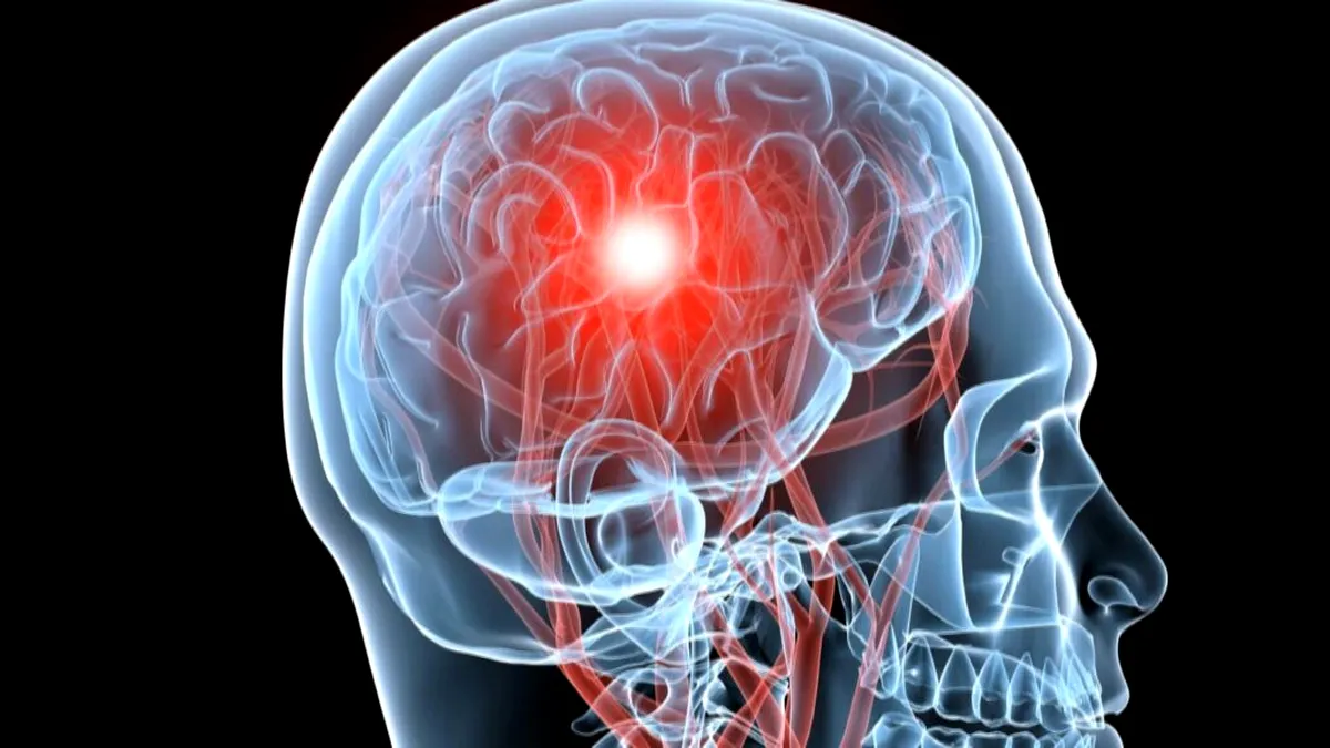 Senzor implantat în creier care ar putea detecta cancerul