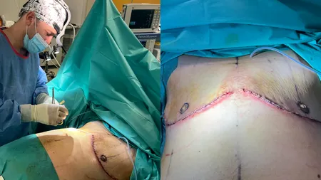 Intervenție chirurgicală de schimbare de sex, la un spital din Iași