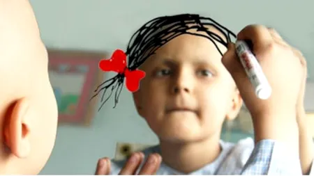 Cercetătorii sunt șocați! Numărul tinerilor diagnosticați cu cancer a crescut cu 80%
