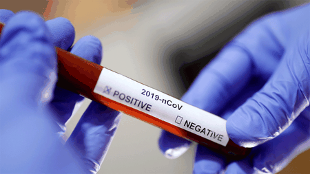 Bilanț coronavirus: 153 cazuri noi de persoane infectate cu SARS – CoV – 2