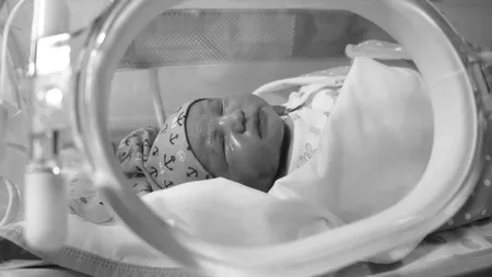 O tânără din Iași a născut un bebeluș de 690 de grame