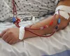 Tratamentele pacienților vulnerabili, salvate temporar de Guvernul Bolojan. Ce categorii de bolnavi sunt vizate