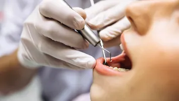 Tratamente dentare cu bani de la stat. Schimbare majoră în sistemul public