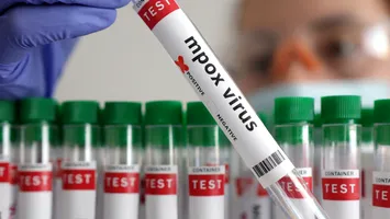 Germania: Primul caz de infecție cu noua variantă a mpox