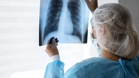 Cancerul pulmonar: Noi terapii prezentate la ASCO 2024 de la Chicago