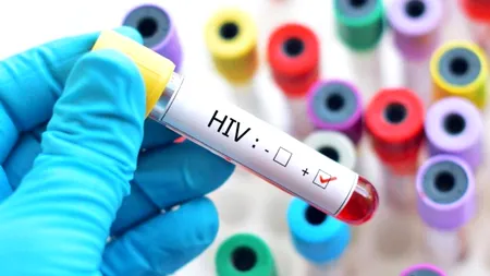 O italiancă a primit 145.000 de euro, după ce s-a infectat cu HIV într-un laborator din Geneva