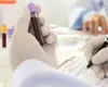 Fonduri pentru analize rămase nefolosite. Șeful CNAS acuză: „Unii furnizori preferă banii cash”