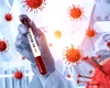 Se întoarce pandemia? O nouă tulpină de SARS-CoV-2, depistată în Franța și SUA