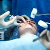 Care este noul lux în chirurgia estetică? Grăsimea colectată de la decedați