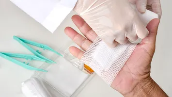 Pansamentul inteligent vă ajută să detectați imediat infecțiile bacteriene și să le tratați rapid