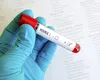 Gripa aviară: Situația devine alarmantă în Asia-Pacific, avertizează ONU