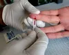 Epidemie în plin sezon estival: autoritățile emit avertismente de călătorie pentru patru destinații turistice populare din Europa. Nouă persoane au murit