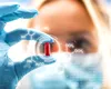 Un medicament anti-malarie, leac minune contra cancerului?!