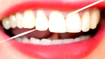 Ața dentară care arată cât de stresați sunteți! Cheia tehnologiei: un material inovator