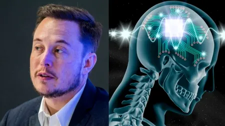 Finanțare pentru o tehnologie a lui Musk, testată deocamdată pe porci şi o maimuţă