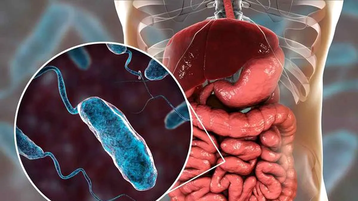Vibrionul holeric: Tulpina izolată nu provoacă boală omului, transmite Ministerul Sănătății