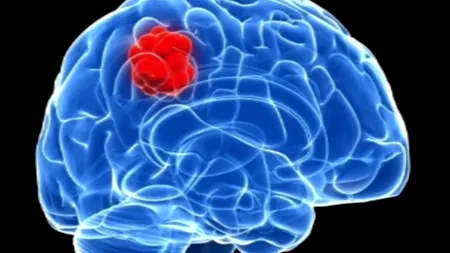 O britanică, super supraviețuitoare a unui cancer aproape incurabil