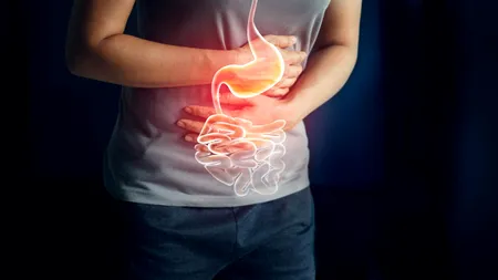 Medicament contra colitei ulcerative, aprobat de Comisia Europeană