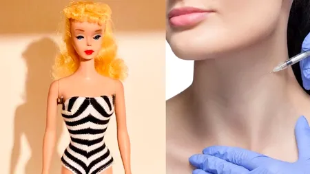 Barbie Botox, noul trend în injectarea de botox, o procedură cu riscuri
