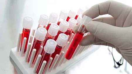 Greșeli care pot influența rezultatele analizelor de sânge, inclusiv diagnosticul