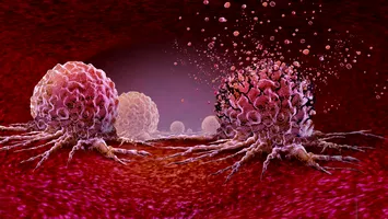 Antrenamentul de 30 de minute care ar putea reduce creșterea celulelor canceroase cu 30%