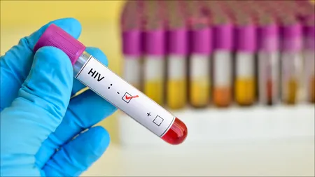 Oamenii de știință au găsit un vaccin împotriva HIV. Pentru a obține imunitate, va fi necesar să se facă două injecții pe an