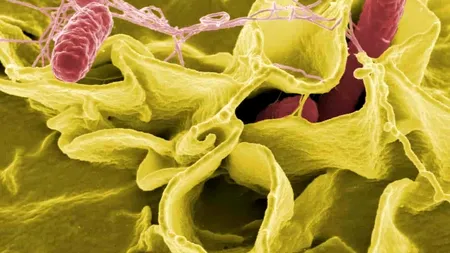 Epidemie de salmoneloză în Europa, transmite Centrul european pentru prevenirea și controlul bolilor