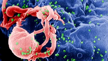 Pas istoric în vindecarea HIV. Oamenii de știință au găsit soluția pentru a elimina complet ADN-ul virusului