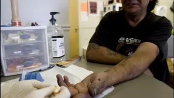 Speranță în lupta contra HIV: un nou tratament injectabil ar putea schimba prevenția