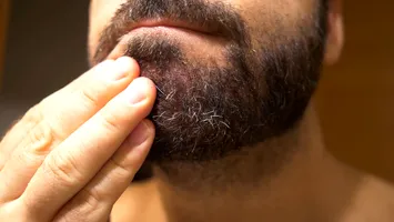 Descoperirea care le schimbă viața bărbaților. Barba, rezervor de bacterii. Conține mai mulți germeni decât o toaletă