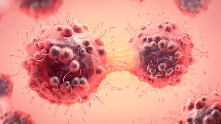 Cancer: Testul care arată dacă boala migrează la alte organe