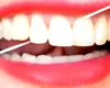 Ața dentară care arată cât de stresați sunteți! Cheia tehnologiei: un material inovator