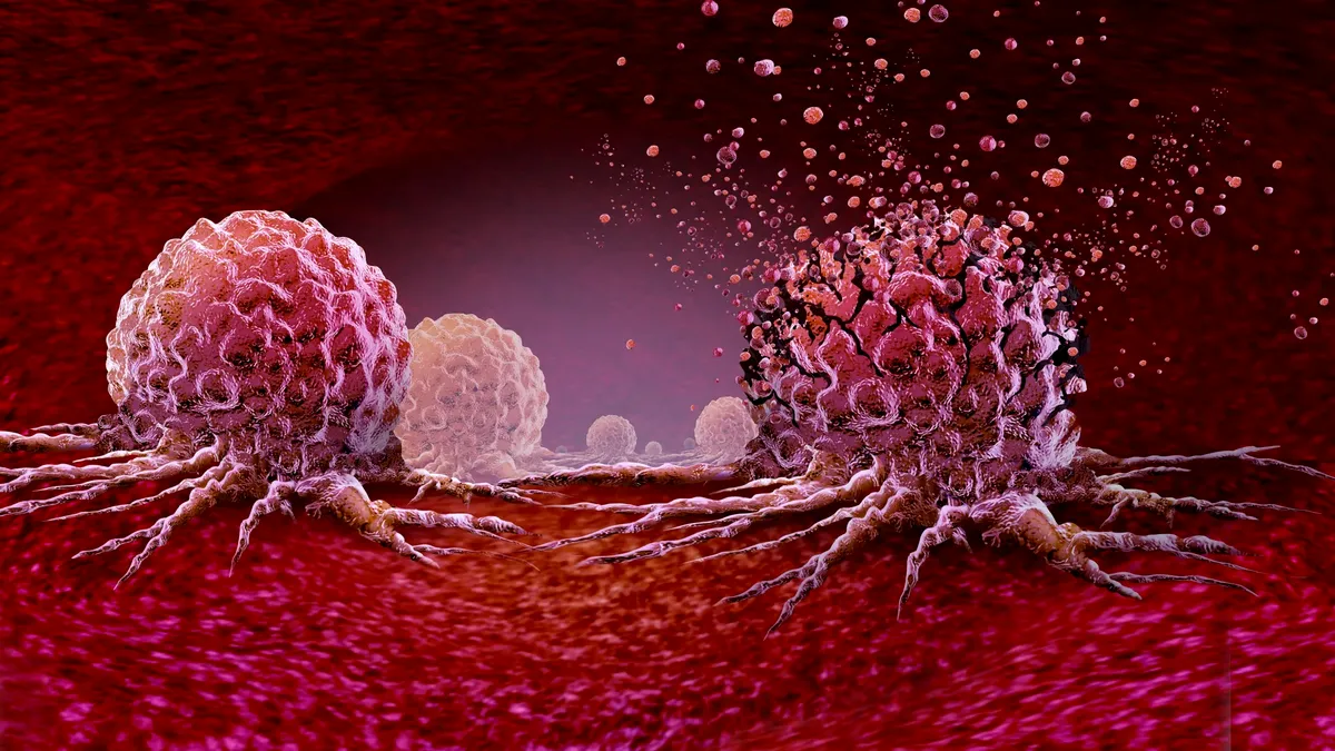 Antrenamentul de 30 de minute care ar putea reduce creșterea celulelor canceroase cu 30%