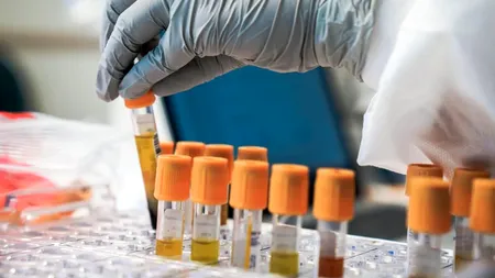 Românii care pot face analize medicale gratuit. Condiția simplă, care îi scutește de costuri