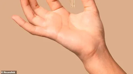 Prima femeie care controlează un computer cu mintea: povestea impresionantă a pacientei care beneficiază de tehnologia Neuralink a lui Elon Musk