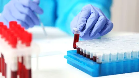 Un ”prim pas crucial” în direcția detectării cancerului  înainte de a ieși la suprafață!