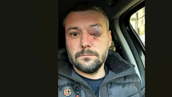 Agresorul directorului Serviciului de Pază Olt, reținut pentru 24 de ore. Scandalul a avut loc în ziua alegerilor prezidențiale