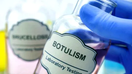 Starea femeii suspecte de botulism este ”ușor ameliorată”. De unde vine toxina botulinică