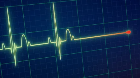 „Fenomenul Lazăr”: Bărbat declarat mort, s-a trezit după 30 de minute. Cazul șocant care a uimit lumea