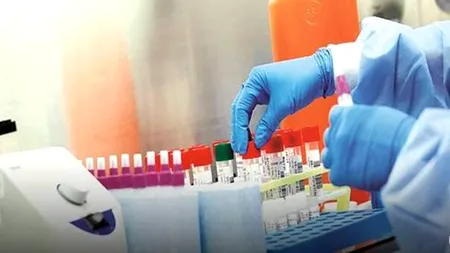 Cât mai costă în România un test RT PCR pentru depistarea coronavirusului