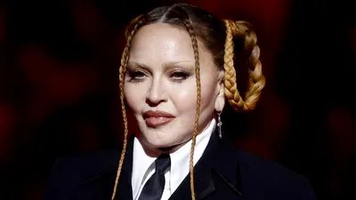 Ce operații estetice are Madonna. La 64 de ani, artista este desfigurată!