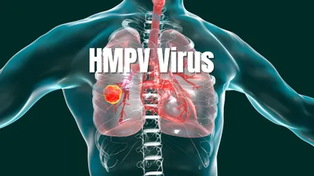 Focar de HMPV în China. Există riscul unei noi pandemii?
