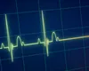 „Fenomenul Lazăr”: Bărbat declarat mort, s-a trezit după 30 de minute. Cazul șocant care a uimit lumea