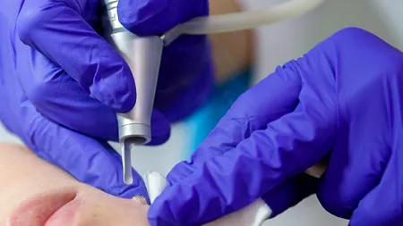 Societatea Română de Dermatologie: 5% din populația României suferă de psoriazis, boală subdiagnosticată și subtratată