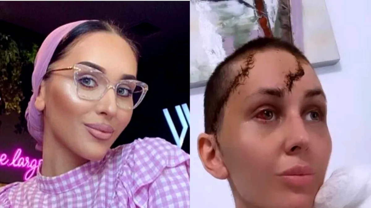 Cum a supraviețuit Dana Roba loviturilor de ciocan. Explicațiile dr. Ciuhodaru