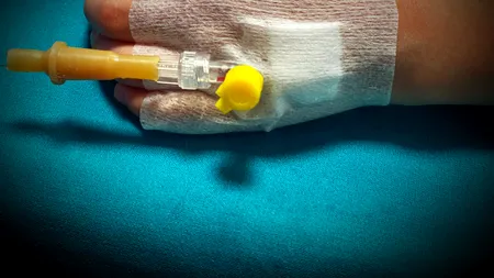 Anchetă la Spitalul Vâlcea, după ce mâna unui copil s-a infectat. Micuțul, lăsat cu branula neschimbată 4 zile